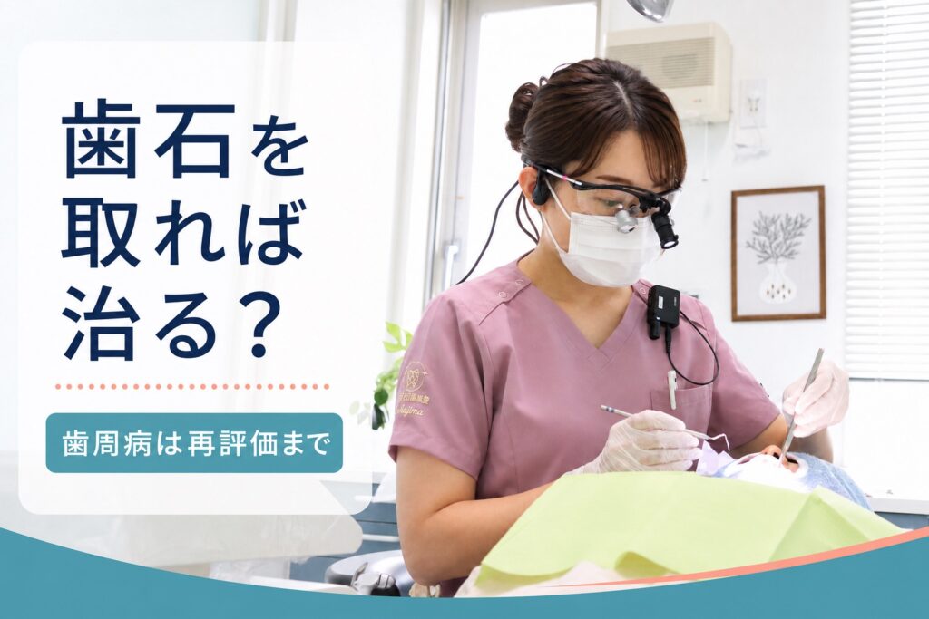 歯石除去後の再評価までが歯周病治療で大切だと伝える50代女性向けアイキャッチ